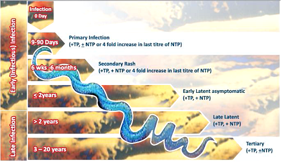 Stages of Syphilis Infection